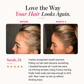 The Red Light Scalp Brush